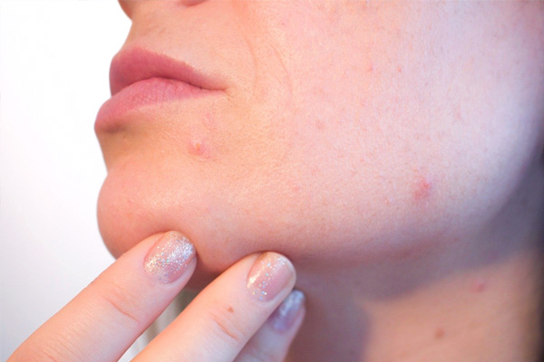 Cuidados de la piel frente al uso de mascarillas y geles