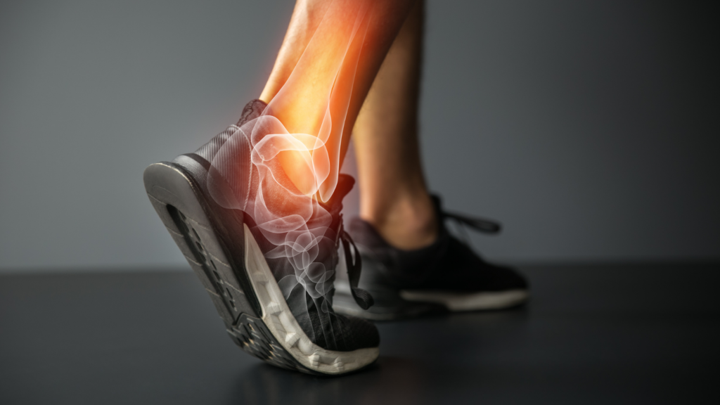 6 medidas para prevenir lesiones deportivas